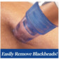 Pore Cleaning Device